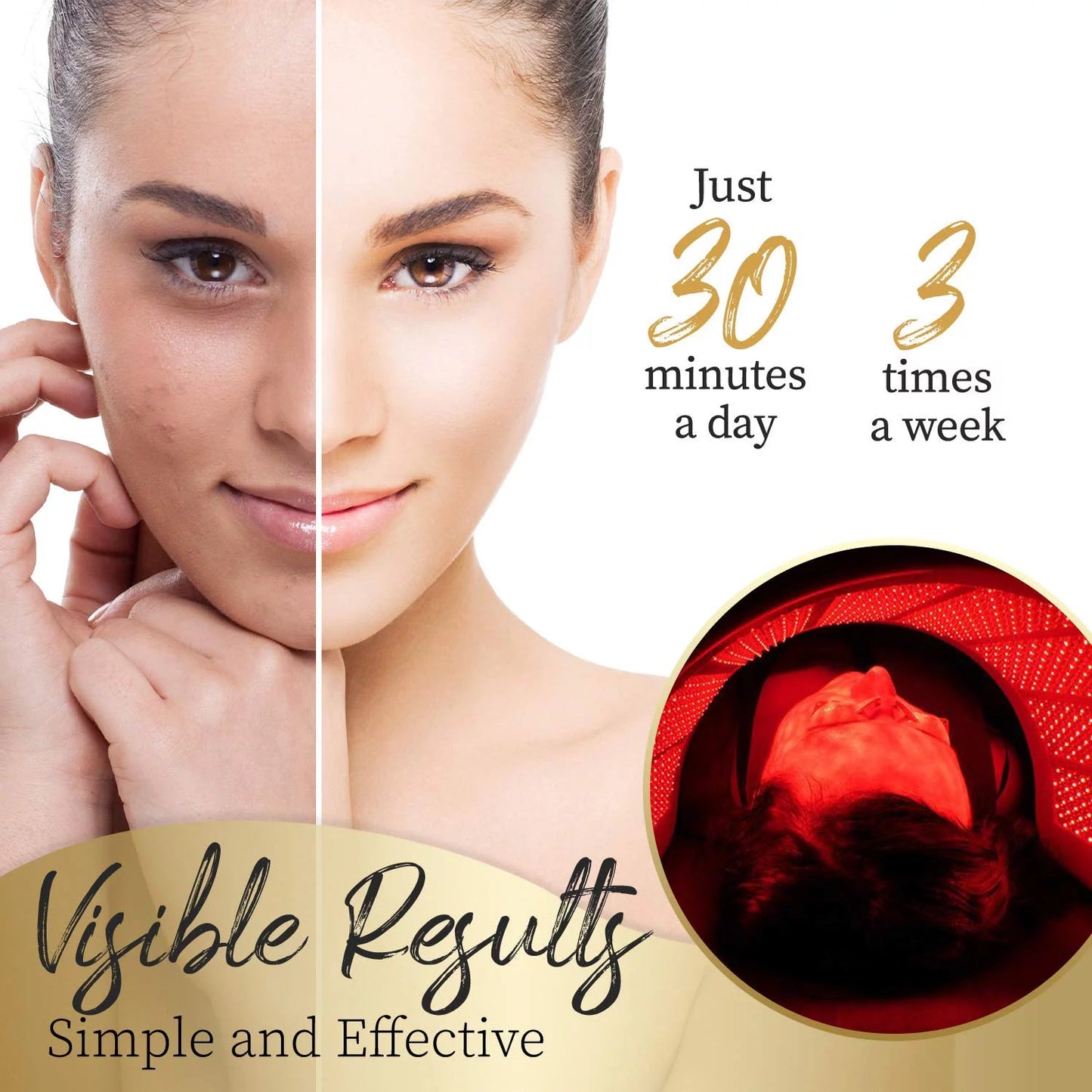 LED Facial Rejuvenation Arch