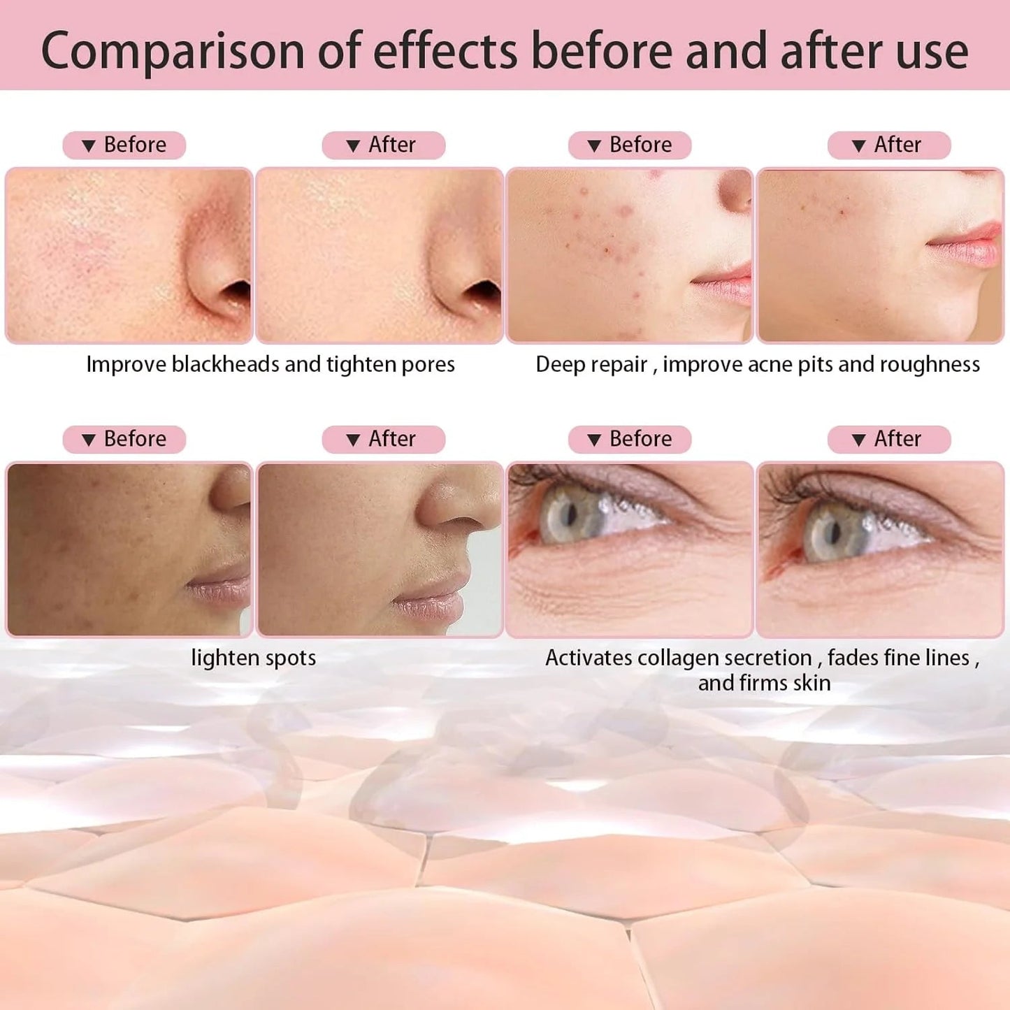 7-Color LED Light Therapy Face Mask