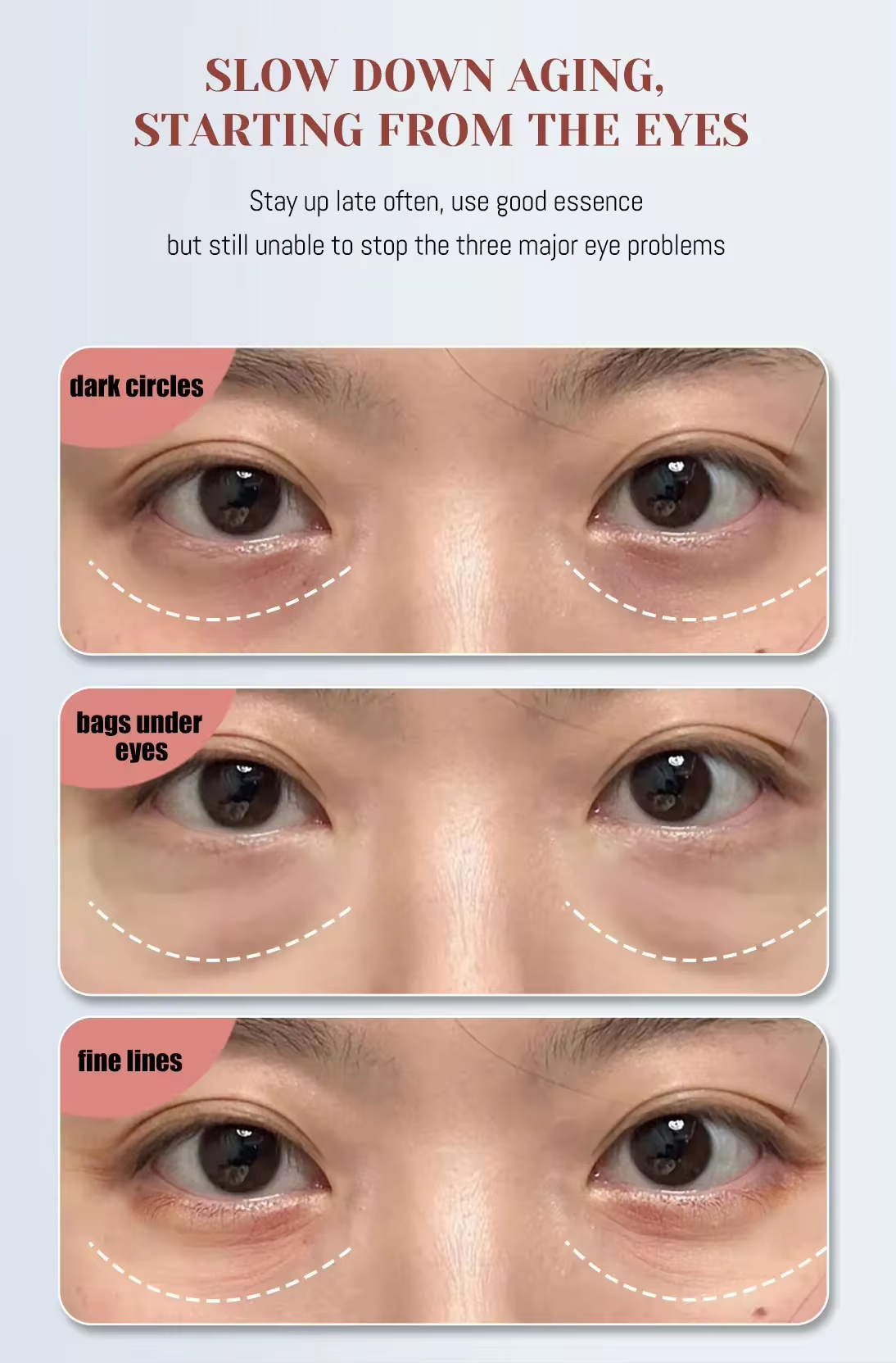 Photon Heating Vibration EMS Microcurrent Eye Care Massager