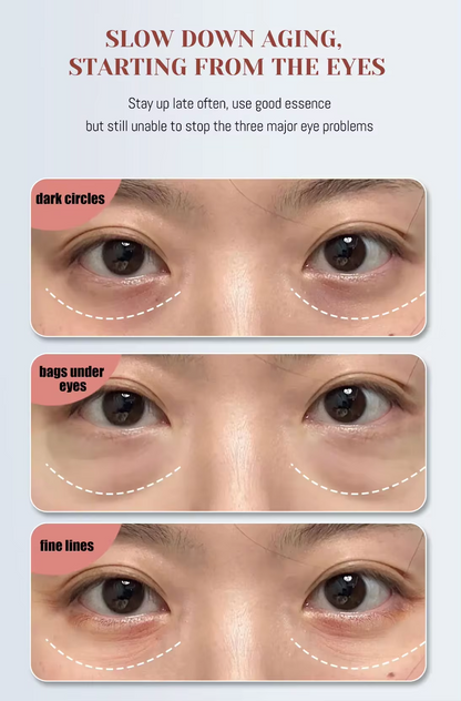 Photon Heating Vibration EMS Microcurrent Eye Care Massager